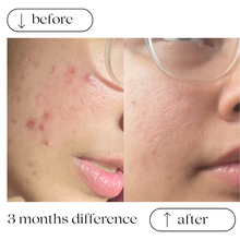 Load image into Gallery viewer, INTENSE HYDRATING SERUM AND CREAM KIT