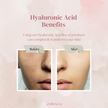 Load image into Gallery viewer, INTENSE HYDRATING SERUM AND CREAM KIT

